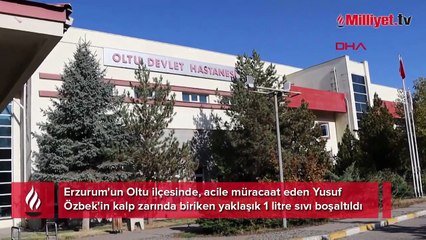 Doktor bile şaşırdı! 'Nefesim daraldı' diye acile geldi, kalbinden 1 litre sıvı boşaltıldı