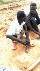 Inspiring Man Overcomes Severe Physical Disability | His Story Will Move You