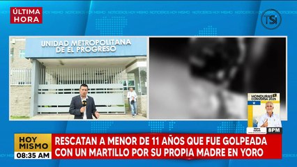 Rescatan a menor de 11 años que fue golpeada con martillo por su madre
