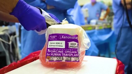 '유전자 편집' 돼지 신장 인간 이식 임상시험 시작 / YTN
