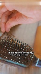 Regain Confidence: Smart Hair Loss Prevention Tips