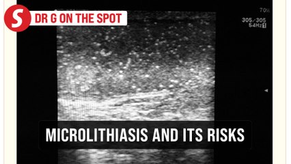 EP298: Testicular microcalcification and risk of cancer | PUTTING DR G ON THE SPOT