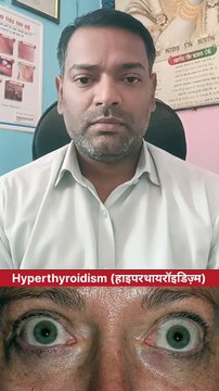 Hyperthyroidism (हाइपरथायरॉइडिज़्म)