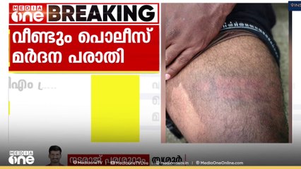 ത‍ൃശൂർ കുന്നംകുളത്ത് വീണ്ടും പൊലീസ് മർദനം; പരാതി നൽകിയത് CPM ഏരിയാ കമ്മിറ്റി