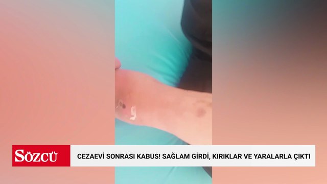 Cezaevi sonrası kabus! Sağlam girdi, kırıklar ve yaralarla çıktı