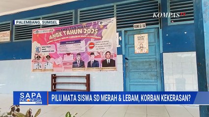 Siswa SD Mata Merah-Lebam Diduga Alami Kekerasan, PPA Palembang Turun Tangan Dampingi Korban