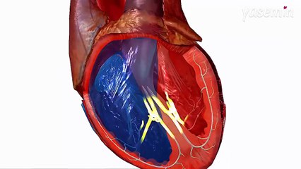 Kalpte delik (ASD) artık kapalı yöntemle hızlı ve güvenli bir şekilde tedavi edilebiliyor!