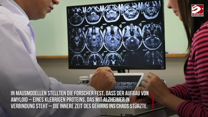 Neue Studie: Alzheimer könnte durch gestörten Schlaf-Wach-Rhythmus angetrieben werden