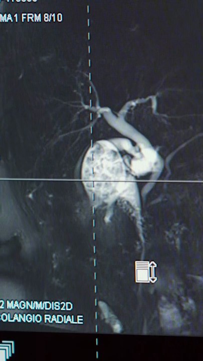 Rocca - Oggi vi portiamo a Colleferro e vi raccontiamo il reparto di Ortopedia e Traumatologia (05.11.25)