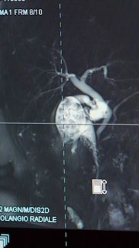 Rocca - Oggi vi portiamo a Colleferro e vi raccontiamo il reparto di Ortopedia e Traumatologia (05.11.25)