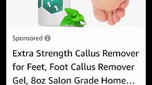 New.Callus Remover for Feet, Extra Strength Foot Callus Remover Gel, 8oz Salon Grade Home Pedicure Supplies for Dry Skin, Cracked Heel,