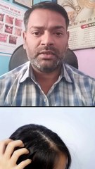 बालों का झड़ना और रूसी का इलाज ।