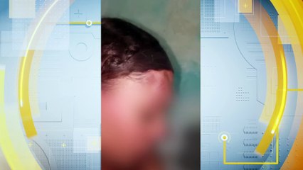 Prisão de entregador após grave agressão a esteticista no Recife: um estudo de caso sobre violência doméstica".