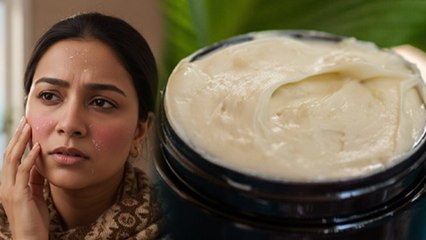 Dry Skin Homemade Cream: ड्राई स्किन के लिए बेस्ट क्रीम,घर पर कैसे बनाएं मॉइस्चराइजर |Boldsky