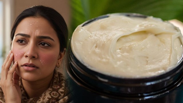 Dry Skin Homemade Cream: ड्राई स्किन के लिए बेस्ट क्रीम,घर पर कैसे बनाएं मॉइस्चराइजर |Boldsky