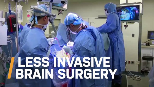 Could Brain Surgery One Day Be Less Invasive? Scientists Think It’s Possible
