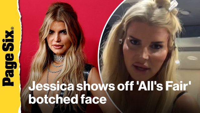 Jessica Simpson proudly shows off botched plastic surgery face in 'All's Fair' behind-the-scenes video