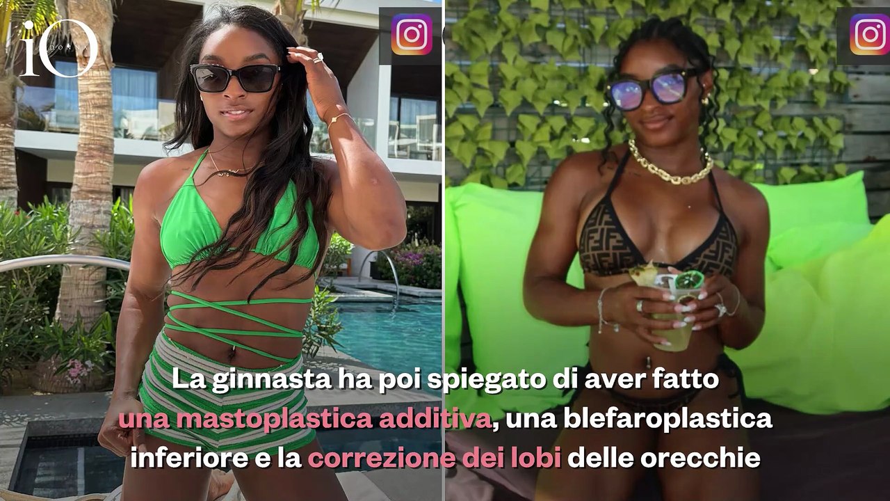 Simone Biles e la chirurgia plastica: «Ho fatto tre interventi estetici, due non li indovinereste mai»