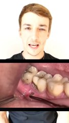 Tu prends soin de tes dents ?