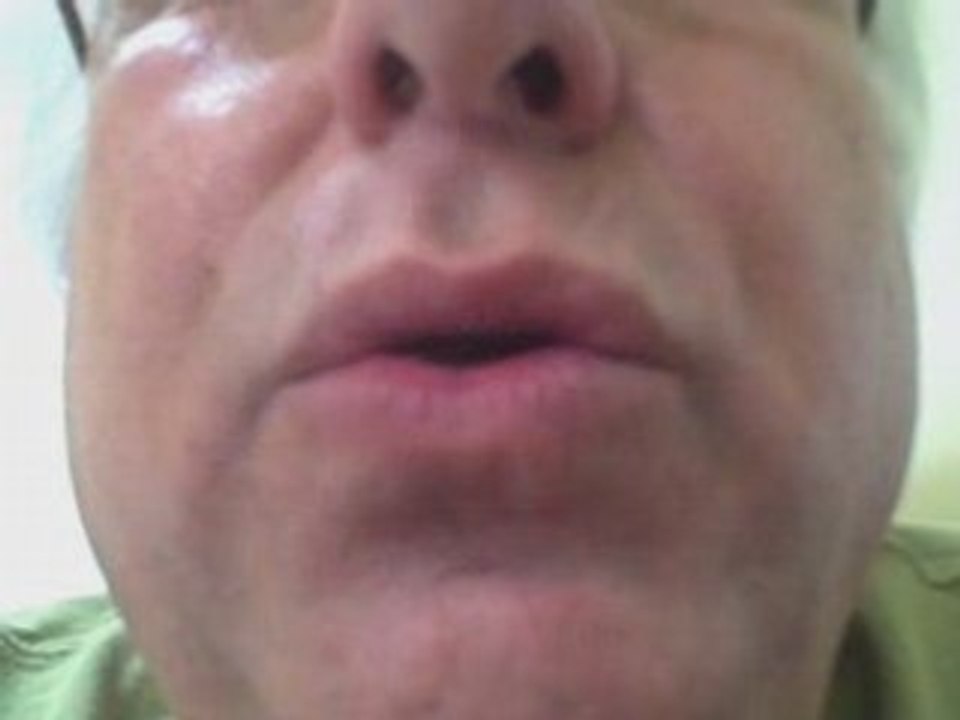 Survivor of Youtube Contest