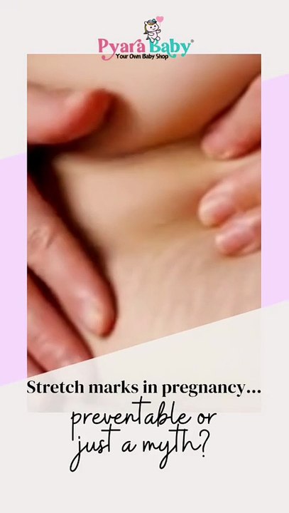 Pregrenanacy stretch marks - pyarababy