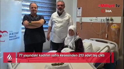 77 yaşındaki kadının safra kesesinden 213 adet taş çıktı