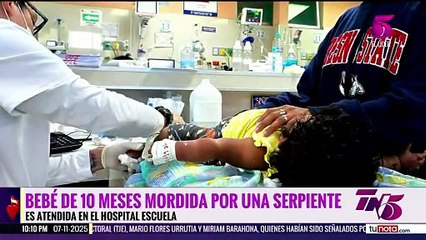 Tres menores más ingresan al Hospital Escuela por mordeduras de serpientes venenosas