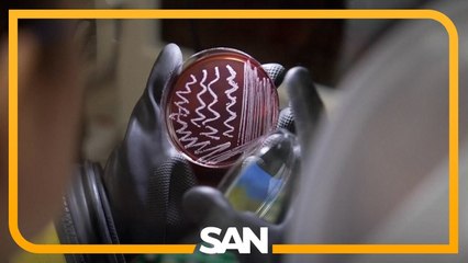 At-home gut microbiome tests grow in popularity, but experts say they’re limited