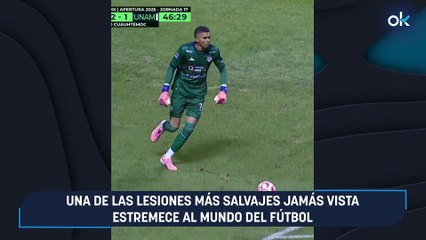 Una de las lesiones más salvajes jamás vista estremece al mundo del fútbol