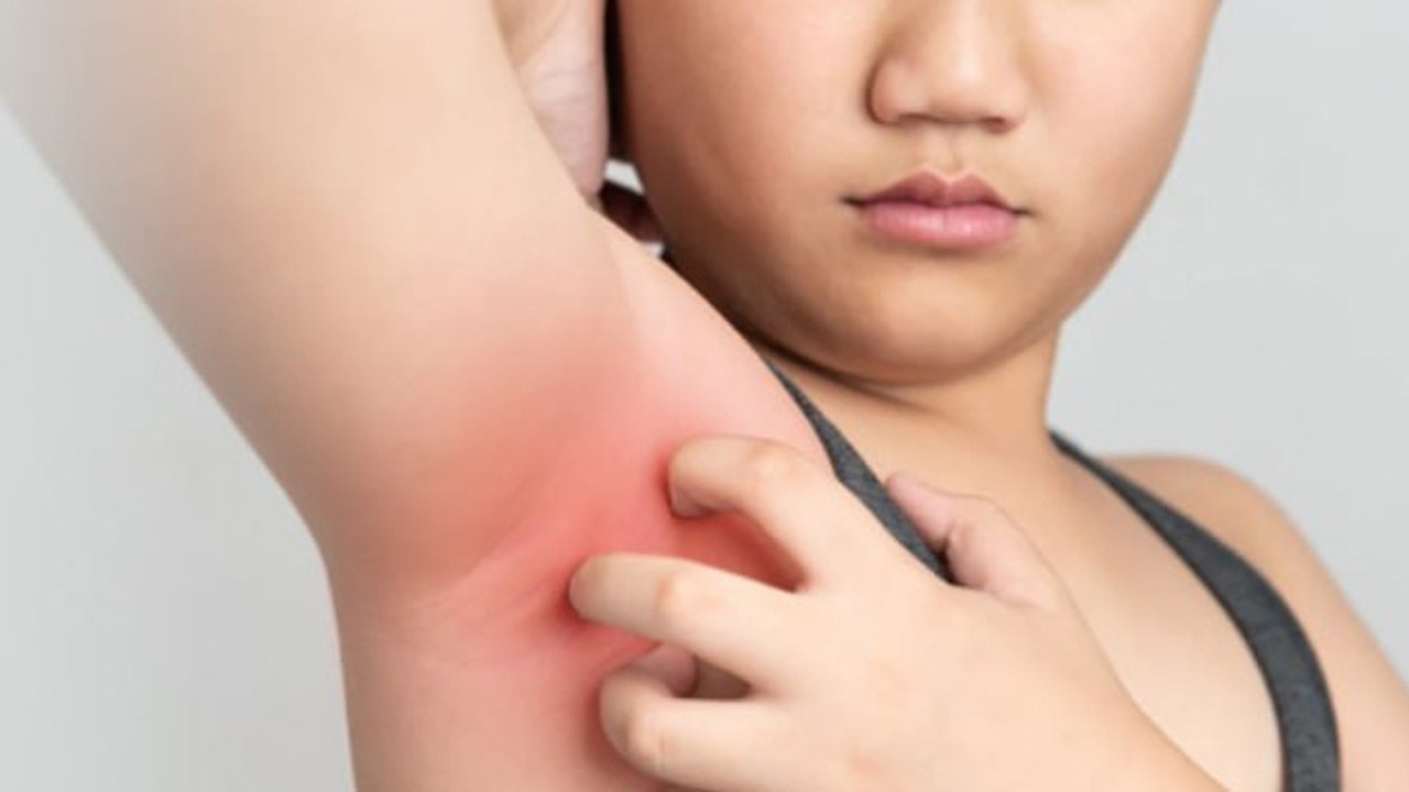 Underarms Skin Tags: बगल में मस्सा क्यों होता है,इलाज क्या है | Underarm Wart Removal |Boldsky