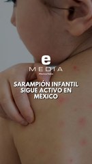 Brote de Sarampión en México sigue en México | Al Cierre