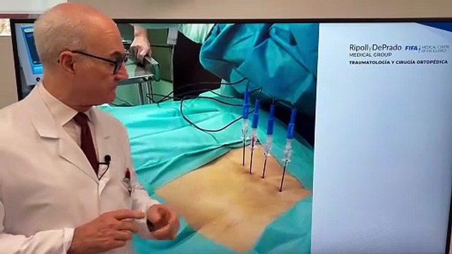 Así es el tratamiento con agujas y ondas electromagnéticas para la pubalgia de Lamine Yamal