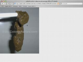 Cleansing the Colon With Colonix - Day 42