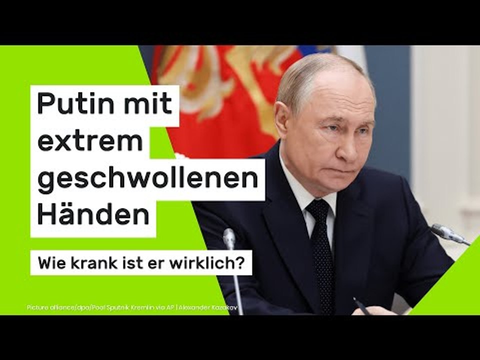 Putin mit extrem geschwollenen Händen - wie krank ist er wirklich?