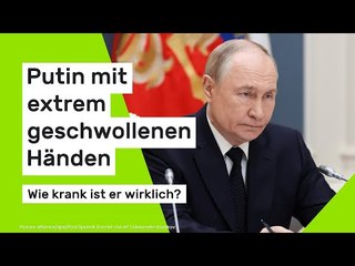Putin mit extrem geschwollenen Händen - wie krank ist er wirklich?