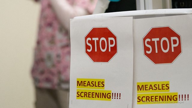 Canada loses measles-free status as cases surge past 5,000