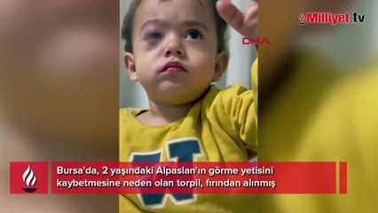 Bursa'da torpil felaketi! 2 yaşındaki çocuğu kör etti: '1 hafta önce satmasın diye yalvarmıştım'