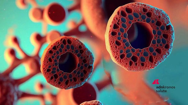 Salute, Talassemia: impatto clinico e prospettive terapeutiche al centro del media tutorial di Avanzanite Bioscience Italia