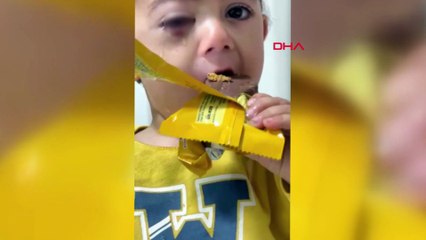 Fırıncı uyarılara kulak asmadı, minik Alperen gözünü kaybetti