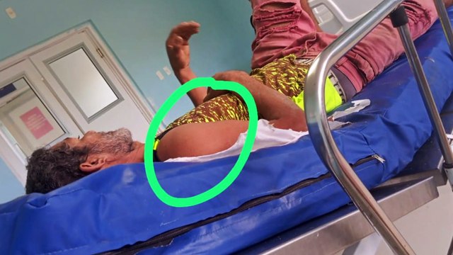 Negligência Médica em Hospital de Barreiros: Homem Morre ao Esperar por Atendimento Após Acidente