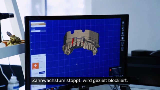 Bald für Kinder erhältlich: Dieses neue Medikament kann Zähne nachwachsen lassen