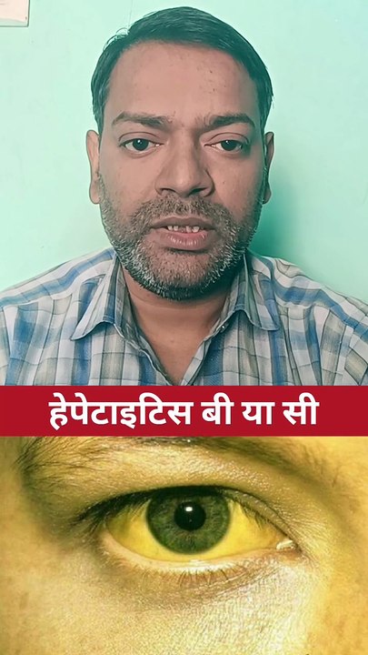 काला पीलिया किस बीमारी को कहते हैं ।