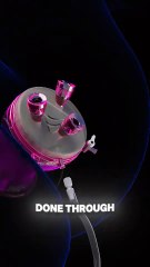 Hysterectomy Procedure Explained | Reasons, Procedure, Risks & Recovery Guide