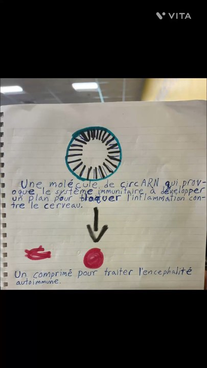 Un médicament pour traiter l’encéphalite auto-immune.