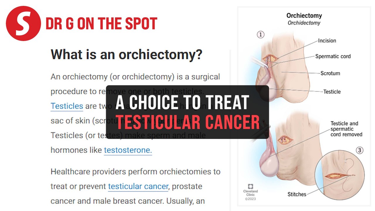 EP300: Mechanism of orchidectomy | PUTTING DR G ON THE SPOT