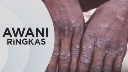 AWANI Ringkas: Penyakit berjangkit