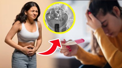 Asherman Syndrome In Hindi: एशरमैन सिंड्रोम क्या होता है,लक्षण और कारण | Symptoms & Causes