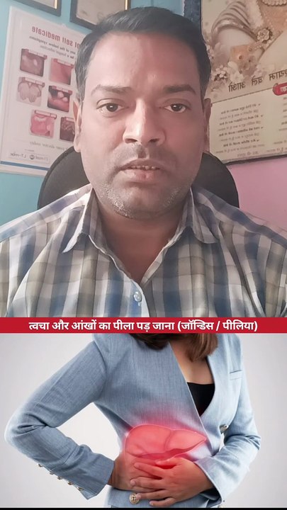 लीवर खराब ।