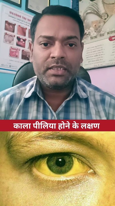काला पीलिया ।