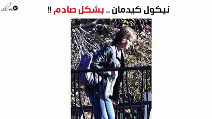 نيكول كيدمان تظهر بشكل صادم!